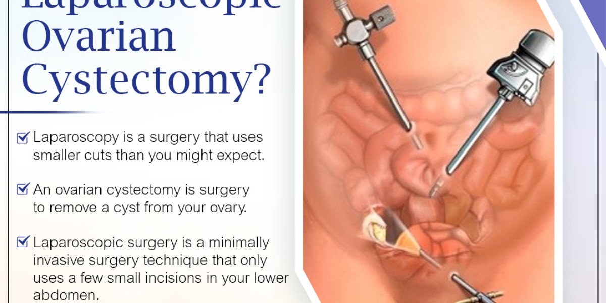 The Benefits of Laparoscopic Surgery: Faster Recovery, Less Pain