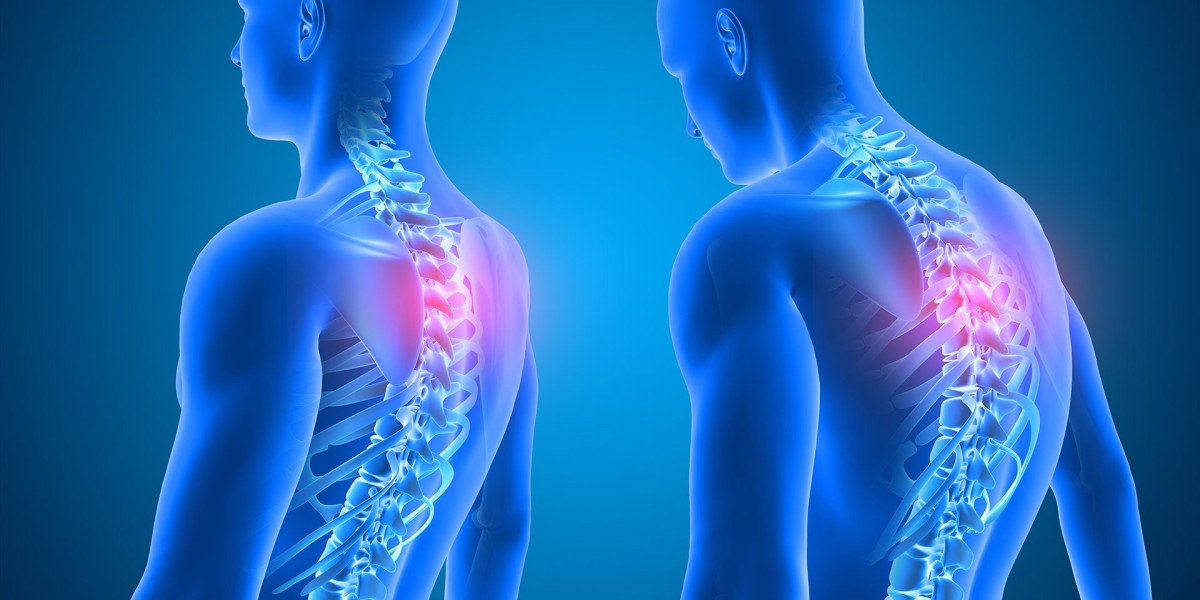 Spine Treatment Options: Understanding the Best Approach for Your Condition