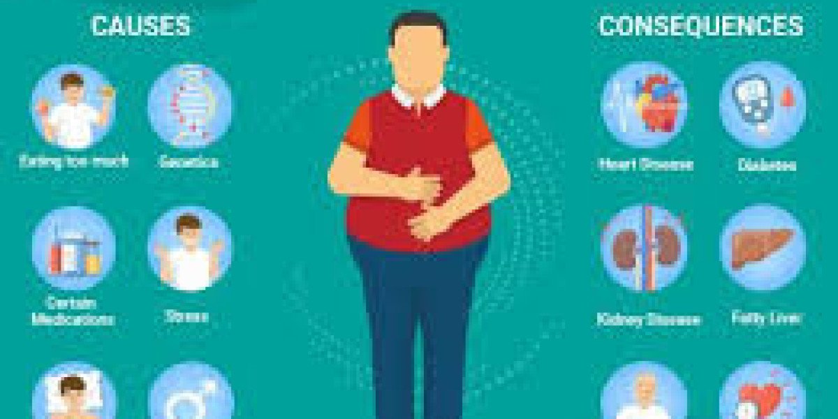 Does Lyrica 150 mg Capsule Cause Weight Gain? Exploring the Role of Pregabalin