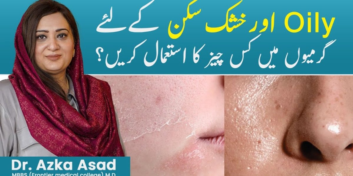 How to Manage Oily Skin in Summer – Simple Skincare Routine