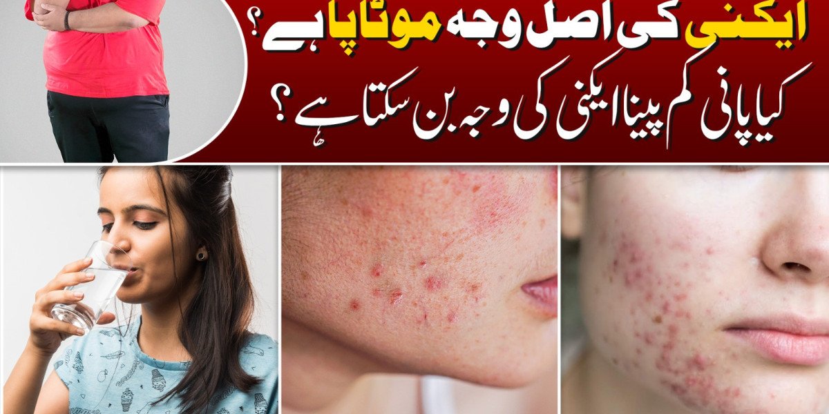 Acne Treatment Guide by Dermatologists – Institute Cosmetique